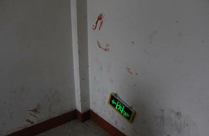 醫(yī)院墻面血漬處理方法，北京航特專業(yè)靠譜更有效！